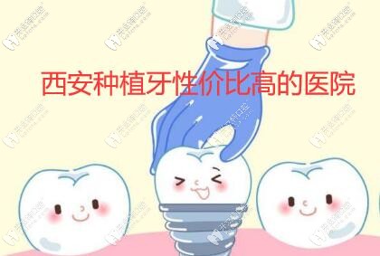 西安種植牙哪家醫(yī)院性價(jià)比高