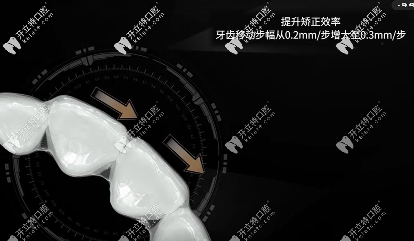 達芬奇Apo雙膜隱形牙套效果怎么樣