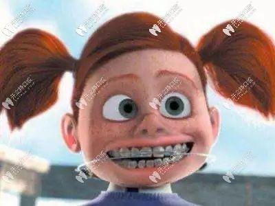 南寧牙百年口腔的正畸