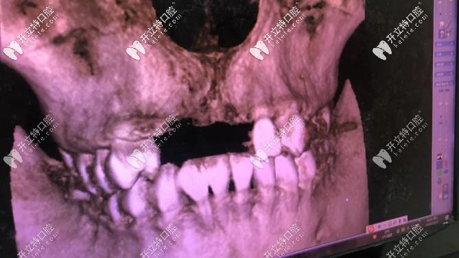 全景影像檢查可快，幾分鐘就出來