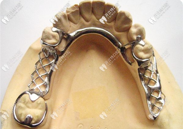 簡單分析下-美國進(jìn)口的諾必靈支架和純鈦支架哪個(gè)好？