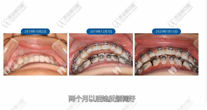 反頜調(diào)好圖片