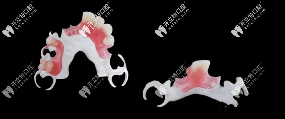 德國比丹HPP圖片