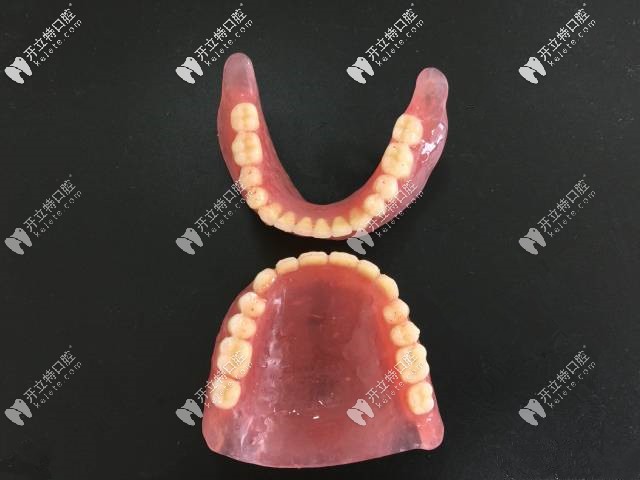 膠連活動(dòng)義齒