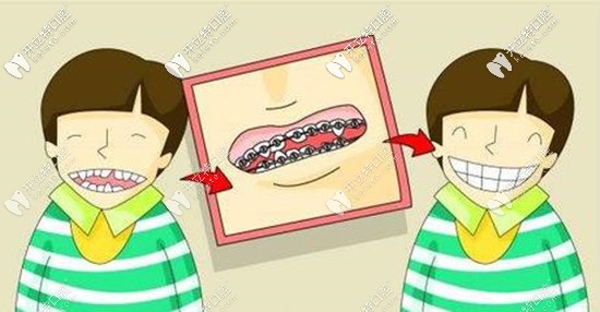 惠州致美口腔做牙齒矯正的費用