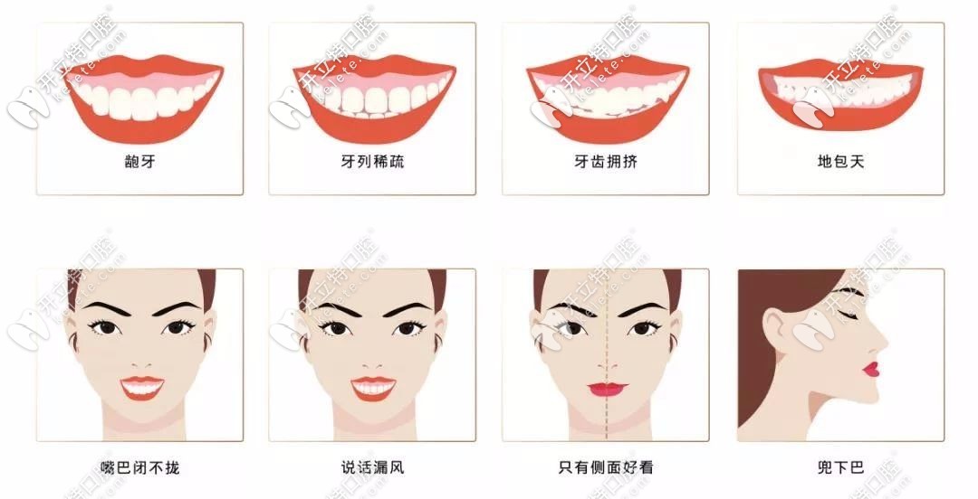 牙齒矯正適應(yīng)癥狀