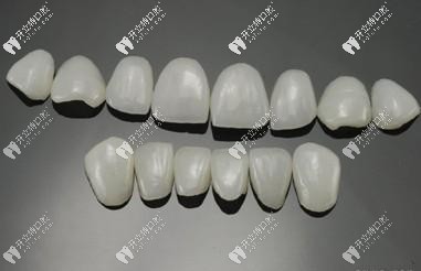 牙齒瓷貼面中的琥珀瓷和藍瓷貼面區(qū)別大嗎?哪個好？