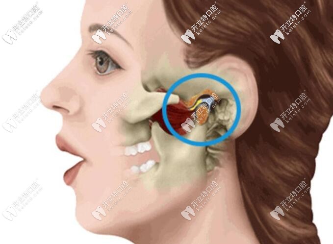 顳下頜關(guān)節(jié)紊亂會(huì)彈響 顳下頜關(guān)節(jié)紊亂會(huì)彈響