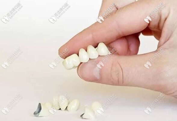 烤瓷牙冠出現(xiàn)牙齦黑線的修復(fù)方法