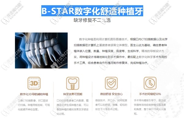 北極星口腔種植牙優(yōu)勢