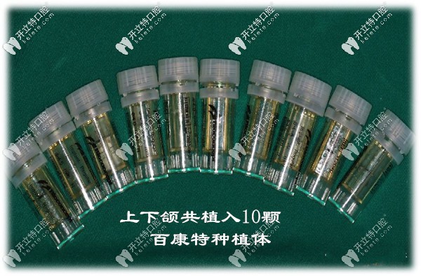 全口植入10顆國(guó)產(chǎn)百康特種植體