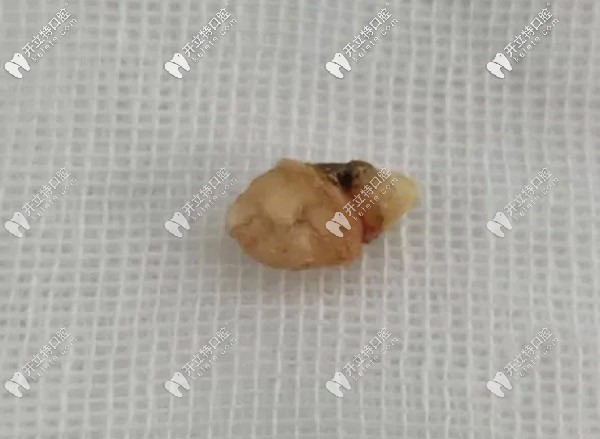 牙齒長鼻子里的圖片