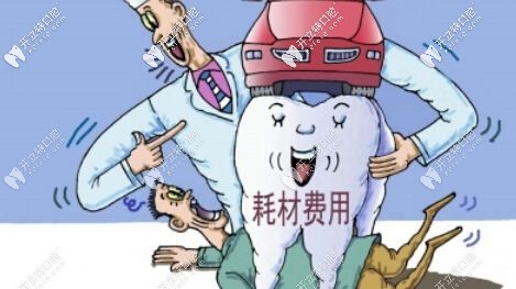 不同植體價格不一樣