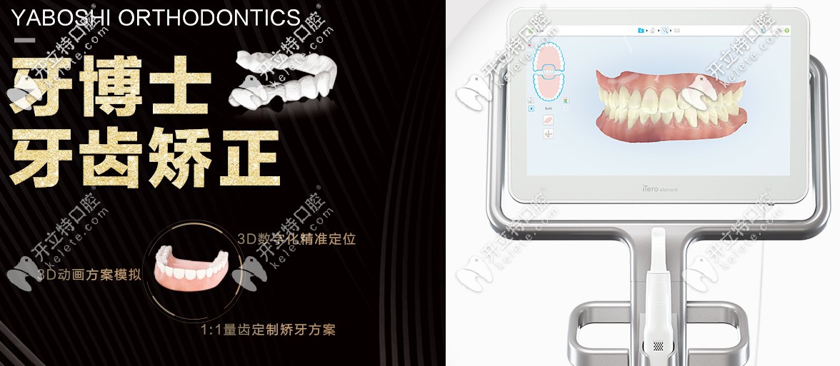 重慶牙博士矯正優(yōu)勢(shì)