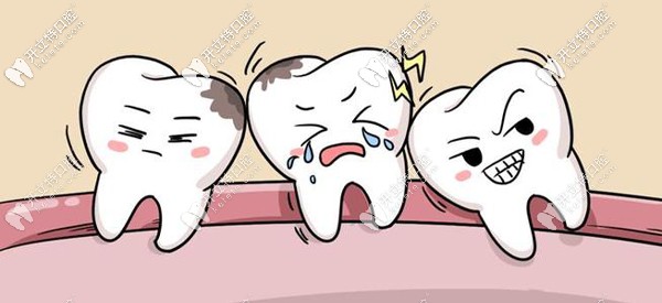 廈門(mén)登特口腔拔智齒多少錢(qián)？想知道登特和公立醫(yī)院比貴么