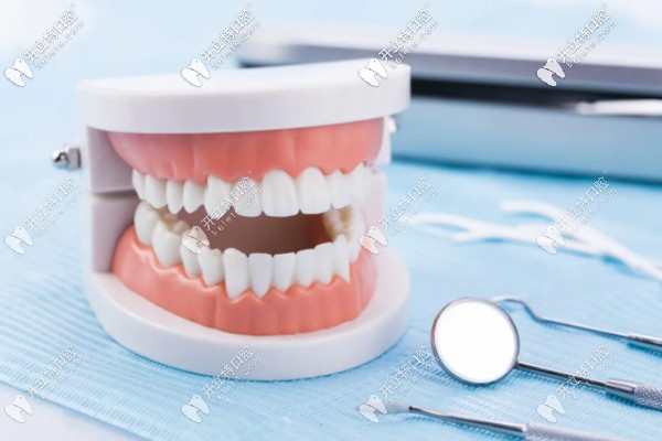 全口種植牙上下6顆種植體的價(jià)格