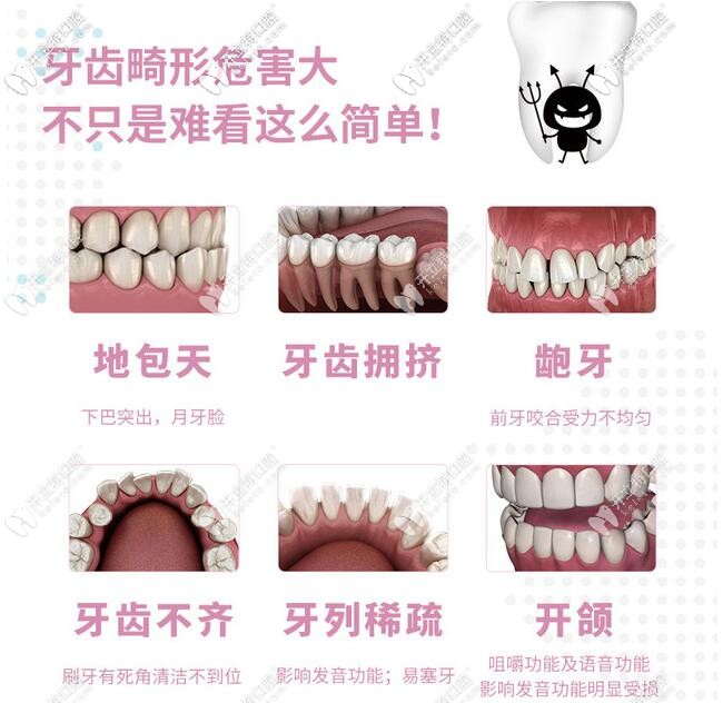 深圳馬瀧齒科牙齒矯正適應(yīng)癥