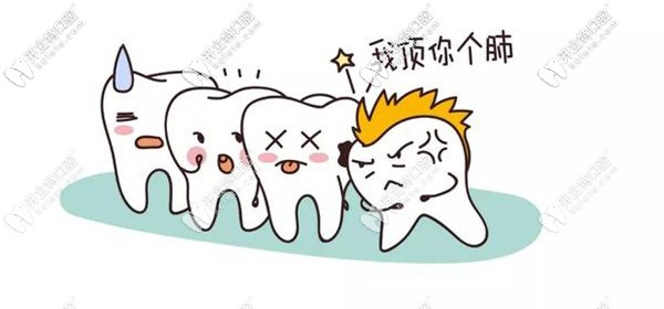 廈門登特口腔拔復(fù)雜智齒較公辦醫(yī)院稍貴