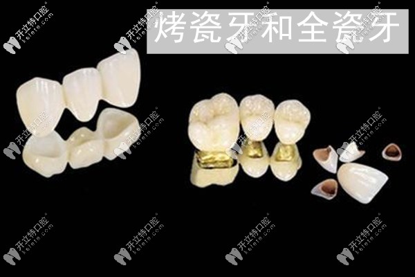 東莞莞大口腔做牙冠的價(jià)格