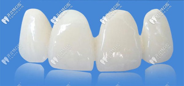 國產美晶瓷PK愛爾創(chuàng)全瓷牙哪個好？來看價格及優(yōu)缺點~