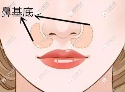 鼻基底示圖