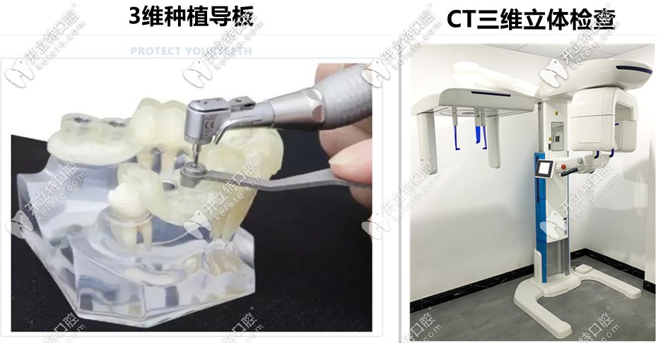 益陽德益口腔—先進數字化設備