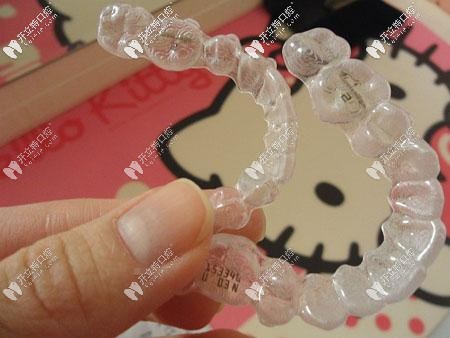 隱適美矯治技術