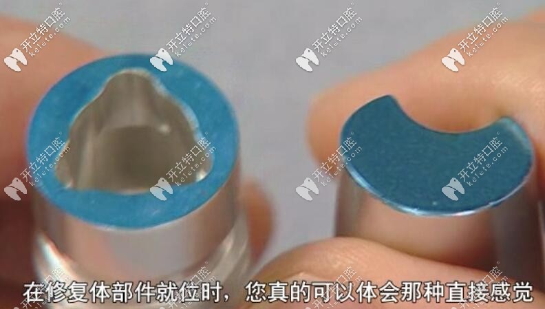 植體和基臺(tái)沒有結(jié)合前的圖片