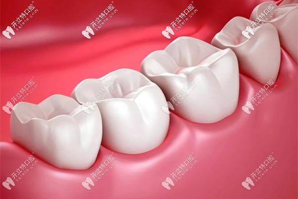 選全瓷牙冠是國(guó)產(chǎn)1600元的好還是進(jìn)口2000元好,其實(shí)不用糾結(jié)