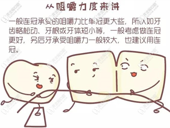 全瓷牙單冠好還是連冠好