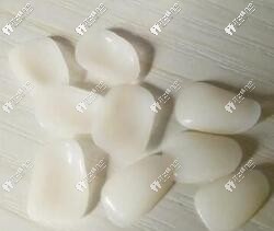 西安牙齒貼面一顆費(fèi)用是多少?樹脂及超薄全瓷貼面價格一覽