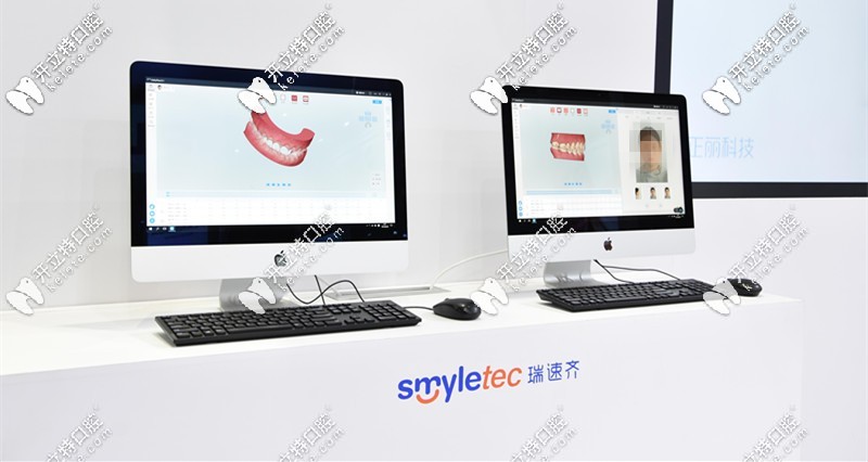 瑞速齊隱形矯正價(jià)格是多少錢？Smyletec是哪個(gè)國家的？