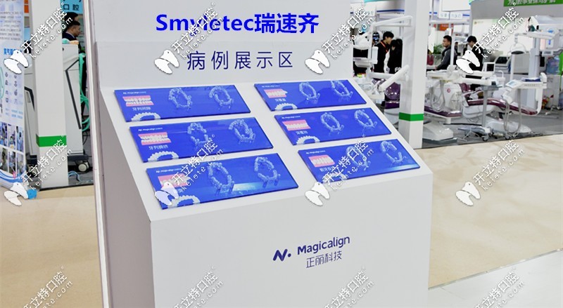 瑞速齊隱形牙套由：天津正麗科技和士卓曼集團(tuán)聯(lián)合推出的