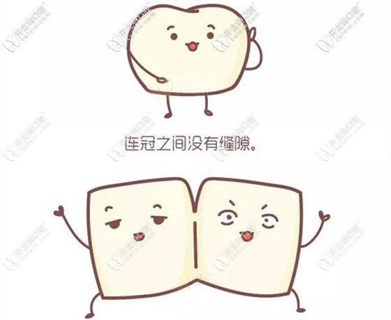 單冠和連冠全瓷牙的利弊