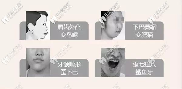 兒童牙齒早期干預適應癥