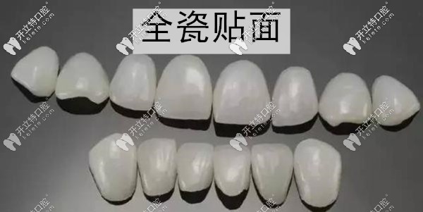 廣州柏德口腔牙齒貼面多少錢(qián)