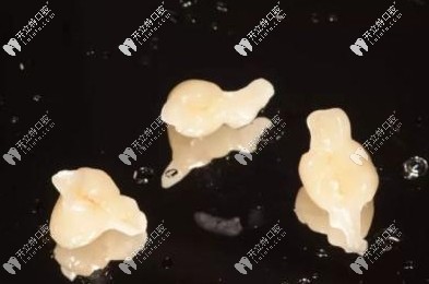 很少有人做馬里蘭橋義齒修復(fù)技術(shù)