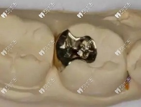 醫(yī)生技術(shù)不豐富，材料填充不嚴(yán)密