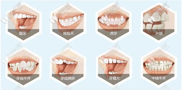 蕪湖矯正牙齒哪家好，這整牙正規(guī)的蕪湖牙科醫(yī)院排名得看