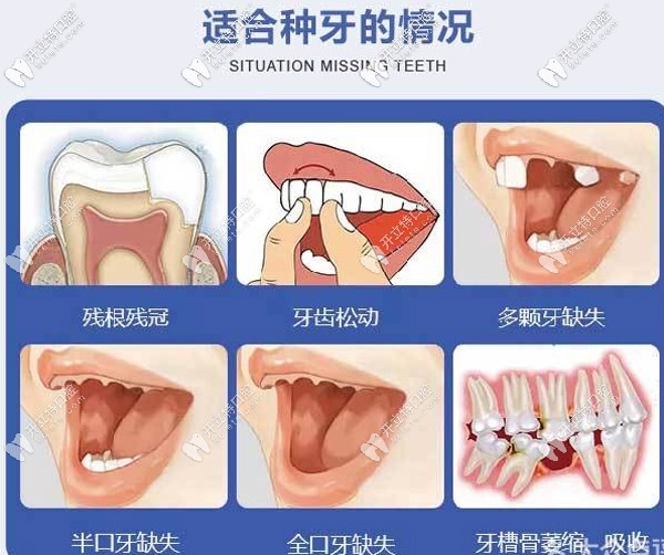 適合做種植牙的情況有哪些