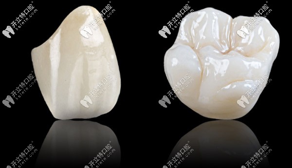 格萊美全瓷牙是進口的嗎，做一顆的價格大概是多少？