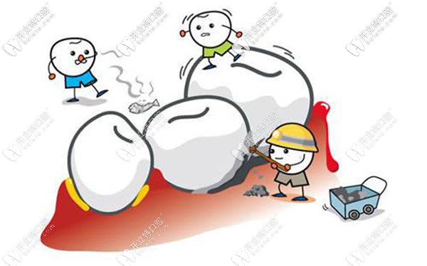 西安洗牙價(jià)格一般多少，西安長(zhǎng)安/未央等11區(qū)潔牙收費(fèi)參考