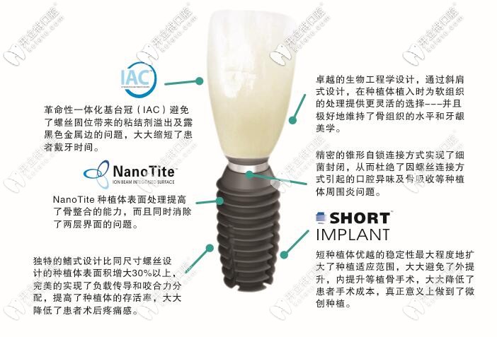 bicon種植體優(yōu)勢介紹