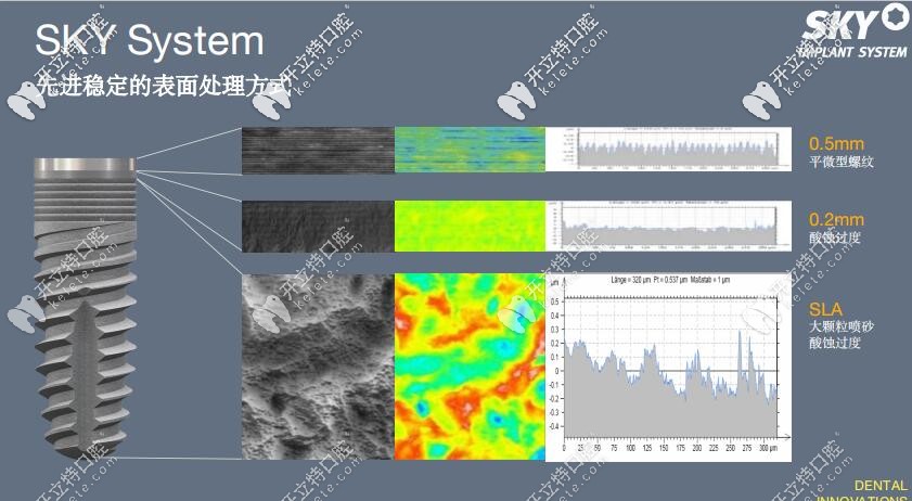 出色的穩(wěn)定性讓它在即刻負重種植上頗有優(yōu)勢