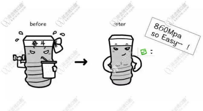 杰美是一款適合后牙種植的的植體↓