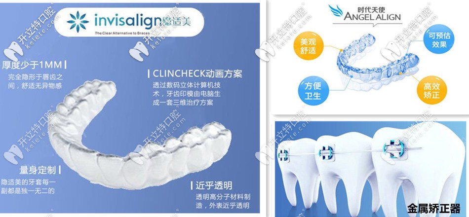 長(zhǎng)沙青橙口腔合作的矯正器含：隱適美、時(shí)代天使等