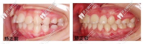 孫丹陽醫(yī)生的矯正<span style=