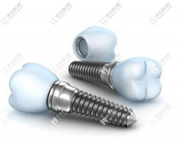 韓國(guó)奧齒泰種植牙