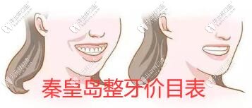 來一份秦皇島整牙價目表,看看各口腔醫(yī)院收費標準是怎樣的