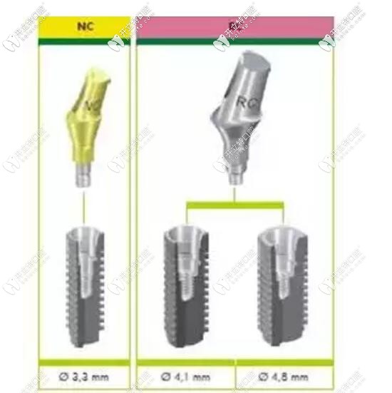 nc和rc對(duì)應(yīng)種植體直徑示意圖